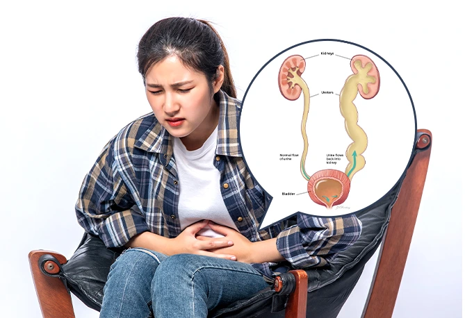 Vesicoureteral Reflux (VUR): Causes, Grades, and Treatment Options